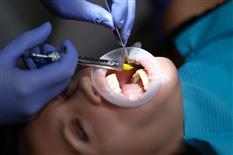 Competency Package for Local Anaesthetic